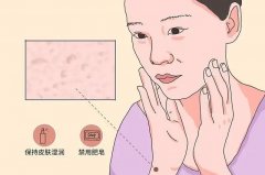 南京皮研所看鱼鳞病怎么样